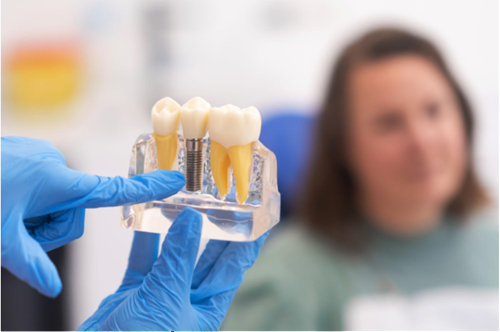 Best Dental Implants in Bangalore at Perfect Smile Dental Clinic