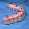 dental solutions