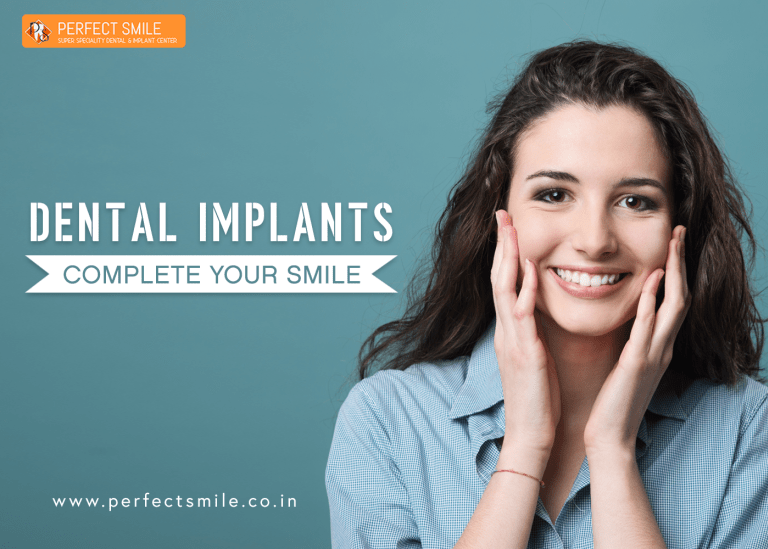 dental-implants-for-multiple-teeth-goa