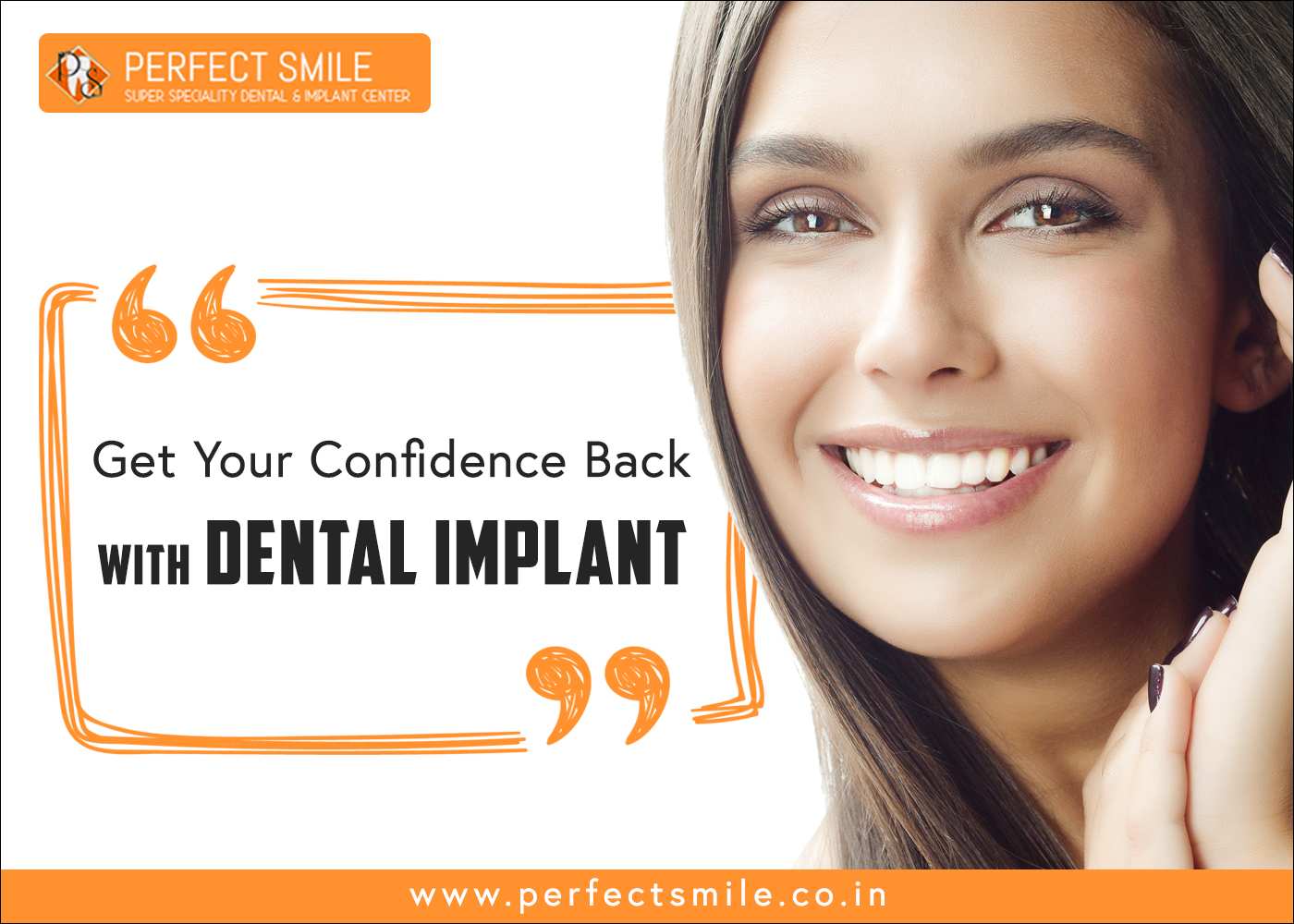 best dental implants bangalore